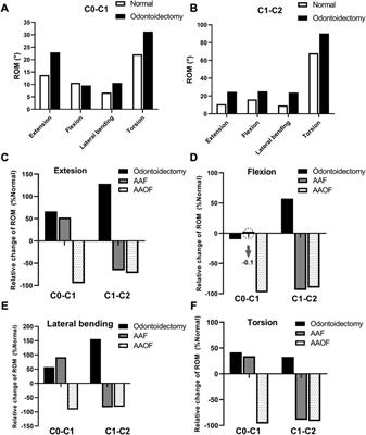 Biomechanical comparison of anterior axis-atlanto-occipital transarticular fixation and anterior atlantoaxial transarticular fixation after odontoidectomy: A finite element analysis